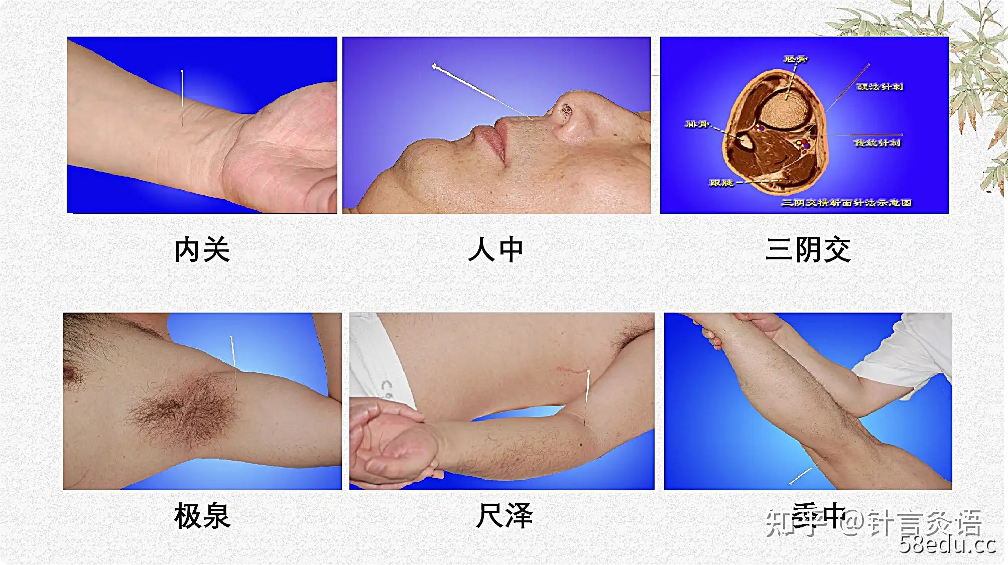 石学敏教授针灸系列视频图解1